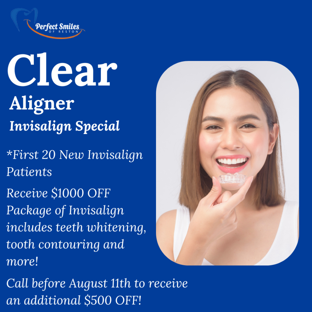 Invisalign Special Reston VA