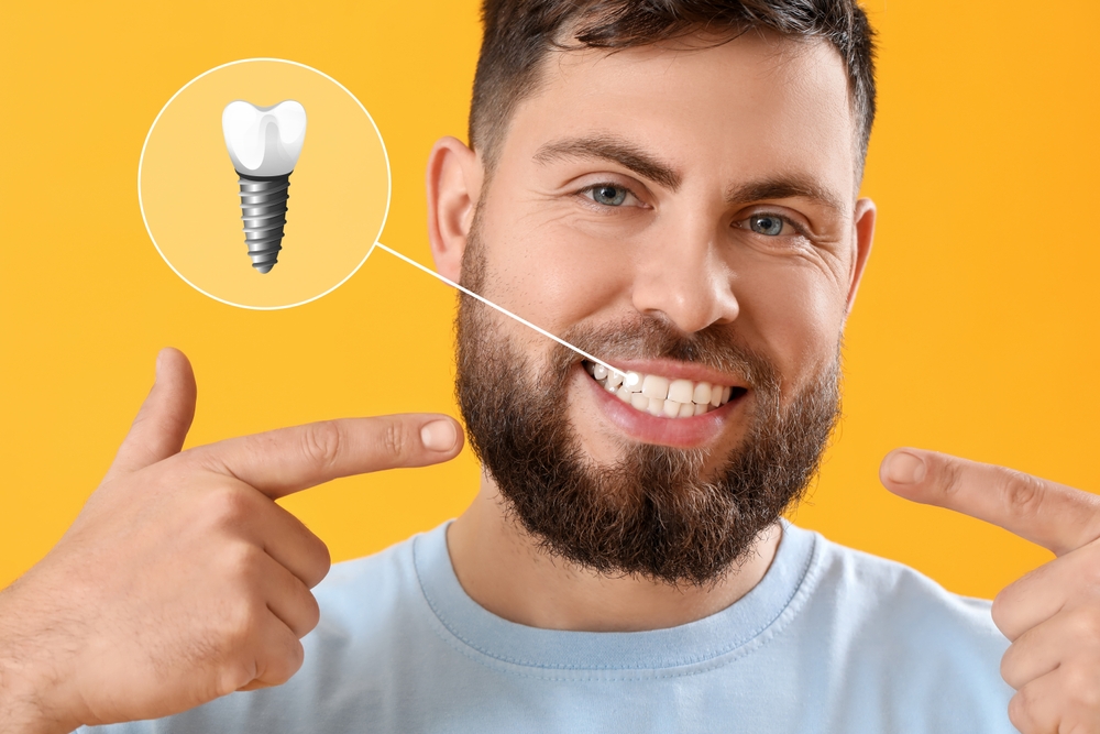 What Happens During a Same-Day Dental Implant in Reston, VA?