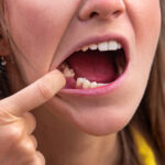 Maintaining your oral health is a key part of keeping your overall health in tip-top shape, so don’t delay necessary care!