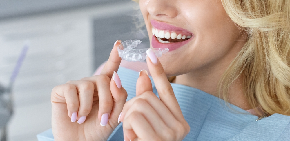 FAQs About the #1 Invisalign in Oakton Virginia