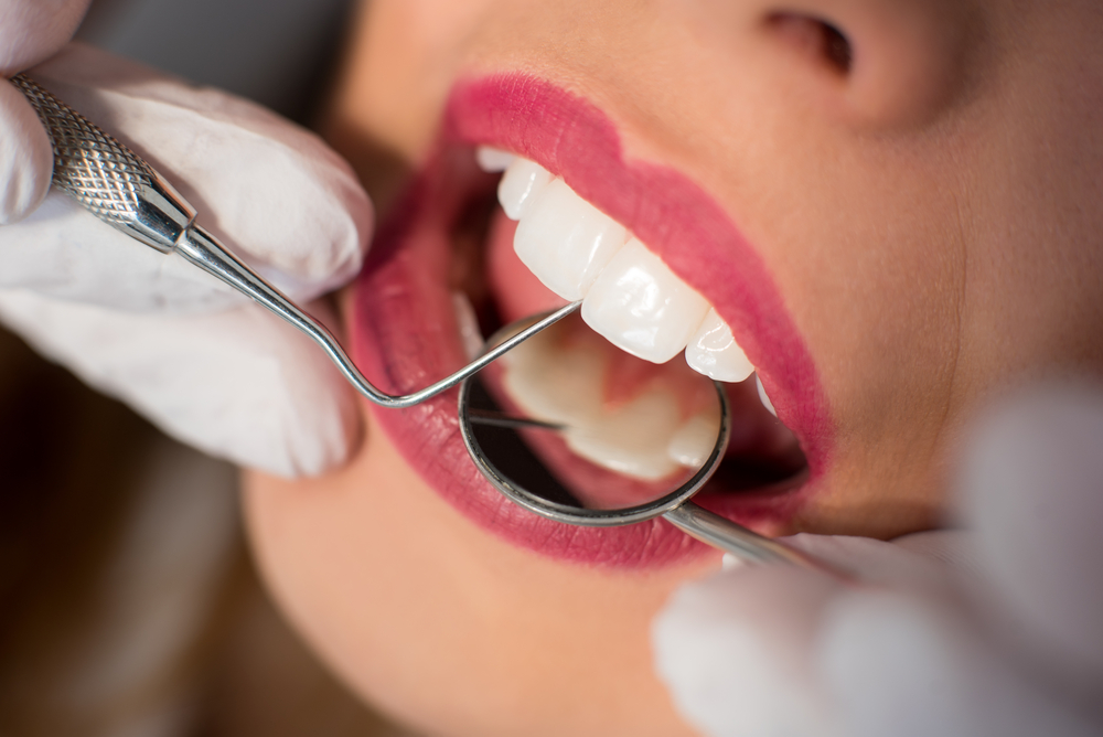 Here's What a Painless Root Canal Specialist in Ashburn Wants You to Know