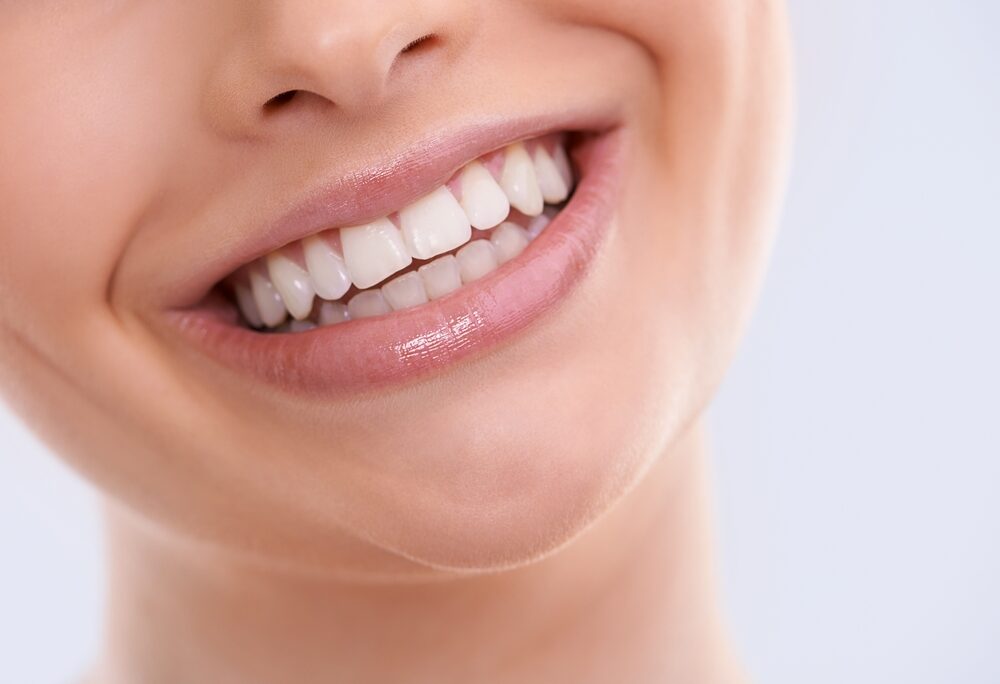 Best Dental Veneer Specialist in Great Falls