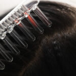 Alma TED Hair Restoration Pricing Near Arlington