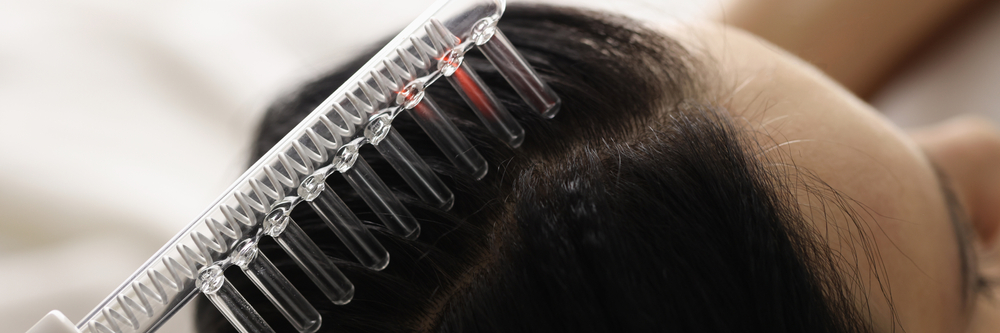 Alma TED Hair Restoration Pricing Near Arlington