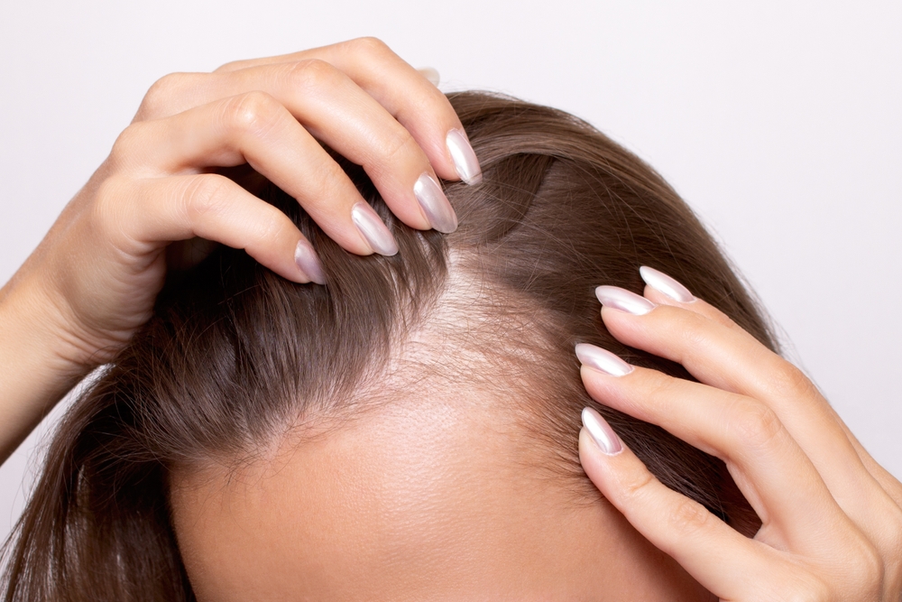 Hair Loss Treatment in Ashburn, Virginia