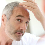Alma Hair Loss Treatment Costs