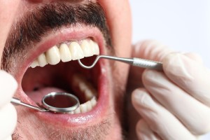 Same-Day Dental Crown Repair Near Tysons Corner: What to Know if You Chip or Break Your Restorative Cap