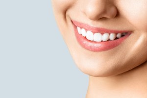 Teeth Whitening vs. Veneers: Best Cosmetic Options in McLean, VA