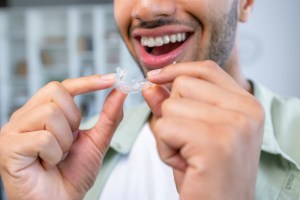 Why Patients in Tysons Corner Are Choosing Invisalign Over Braces