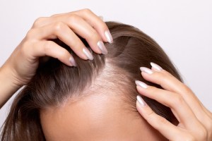 Hair Loss Treatment in Ashburn, Virginia