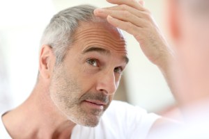 Alma Hair Loss Treatment Costs