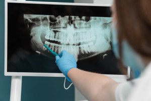 Bright Smiles, Smart Prices: Affordable Dental Exam and X-Ray Appointments in Reston, VA