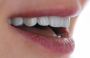 Close-up of CEREC crown placement — durable, custom-milled restoration in one visit