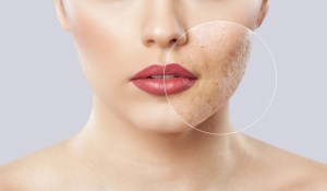 Close-up of woman&rsquo;s face with highlighted area showing skin texture or concern