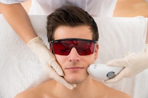 Man wearing protective goggles during facial laser hair removal procedure