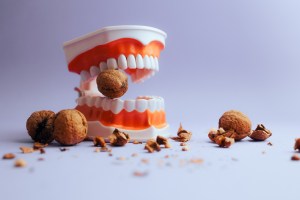 Emergency Dentist for a Cracked Molar Near Reston Virginia
