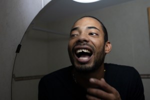 Broken or Chipped Tooth Emergency Dentist Near Herndon