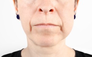 Emergency Dentist for Oral Swelling and Trauma Near Herndon, Virginia: Why You Shouldn’t Postpone Your Dental Care