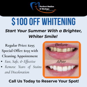 $100 off teeth whitening