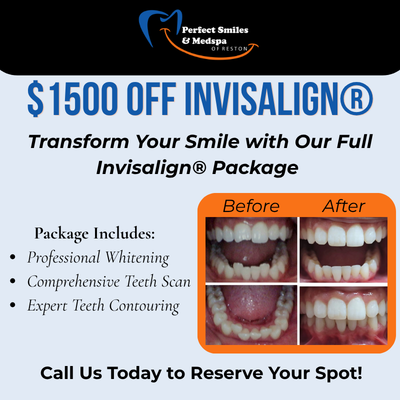 $1500 off Invisalign